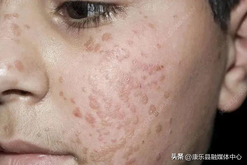 第451页